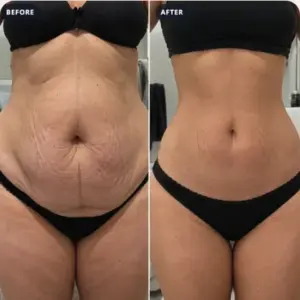 Front-view outfit comparison photograph